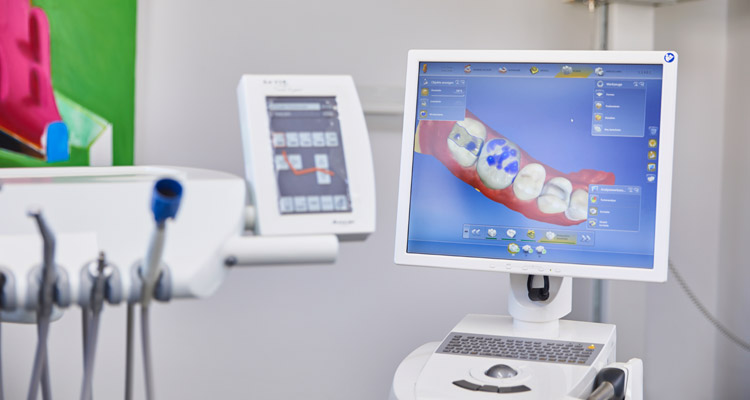 CEREC